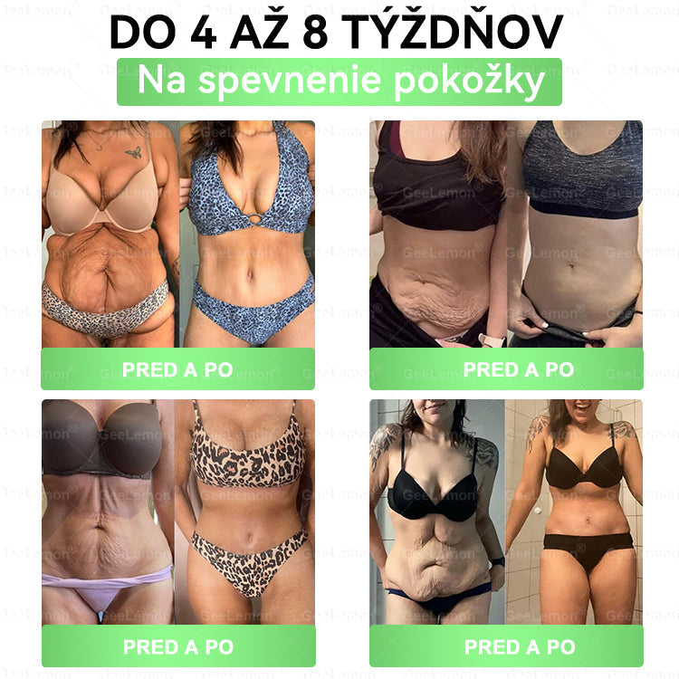 GeeLemon®🎶 Moringa · Berberín × NAD+ 10 v 1 Pokročilý Nano Mikroihličkový Náplasťový Systém ✅ (Stačí raz denne, viditeľné zmeny do 7 dní) Pri obezite, kardiovaskulárnom zdraví, cukrovke,  štítnej žľaze, zdraví čriev, problémoch s kĺbmi a ďalších