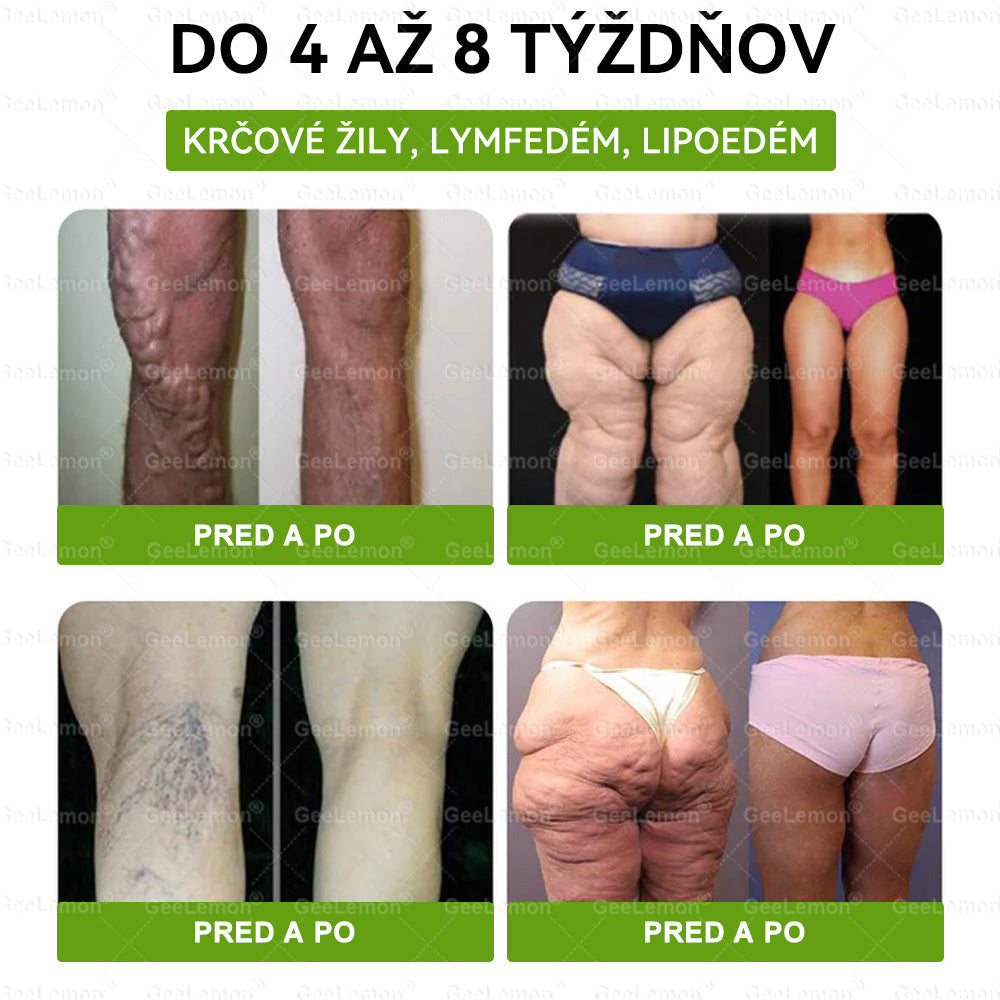 GeeLemon®🎶 Moringa · Berberín × NAD+ 10 v 1 Pokročilý Nano Mikroihličkový Náplasťový Systém ✅ (Stačí raz denne, viditeľné zmeny do 7 dní) Pri obezite, kardiovaskulárnom zdraví, cukrovke,  štítnej žľaze, zdraví čriev, problémoch s kĺbmi a ďalších