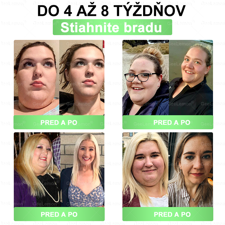 GeeLemon®🎶 Moringa · Berberín × NAD+ 10 v 1 Pokročilý Nano Mikroihličkový Náplasťový Systém ✅ (Stačí raz denne, viditeľné zmeny do 7 dní) Pri obezite, kardiovaskulárnom zdraví, cukrovke,  štítnej žľaze, zdraví čriev, problémoch s kĺbmi a ďalších